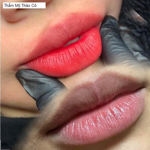 Hình ảnh Thẩm Mỹ Thảo Cỏ