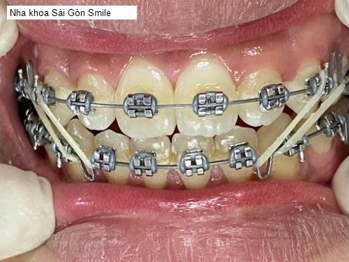 Hình ảnh Nha khoa Sài Gòn Smile